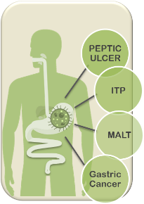 pylori